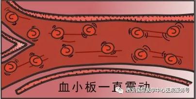 血小板是正常值的三倍？專家提醒小心血栓和出血！