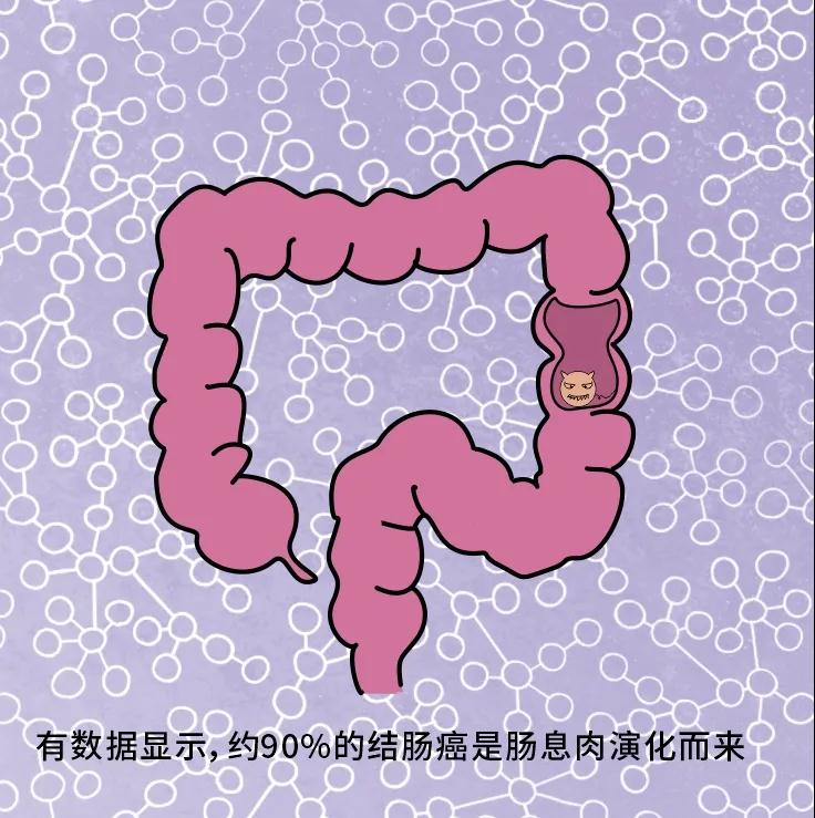 奪走“黑豹”生命的結(jié)腸癌，到底什么來頭？