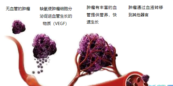 晚期腫瘤為什么會復(fù)發(fā)轉(zhuǎn)移？