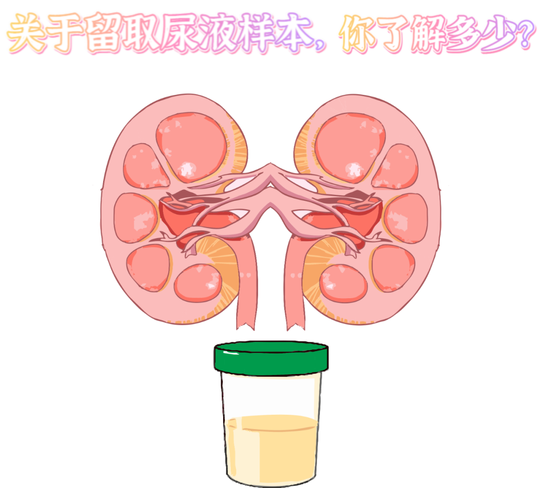 做尿檢，不得不說的注意事項！