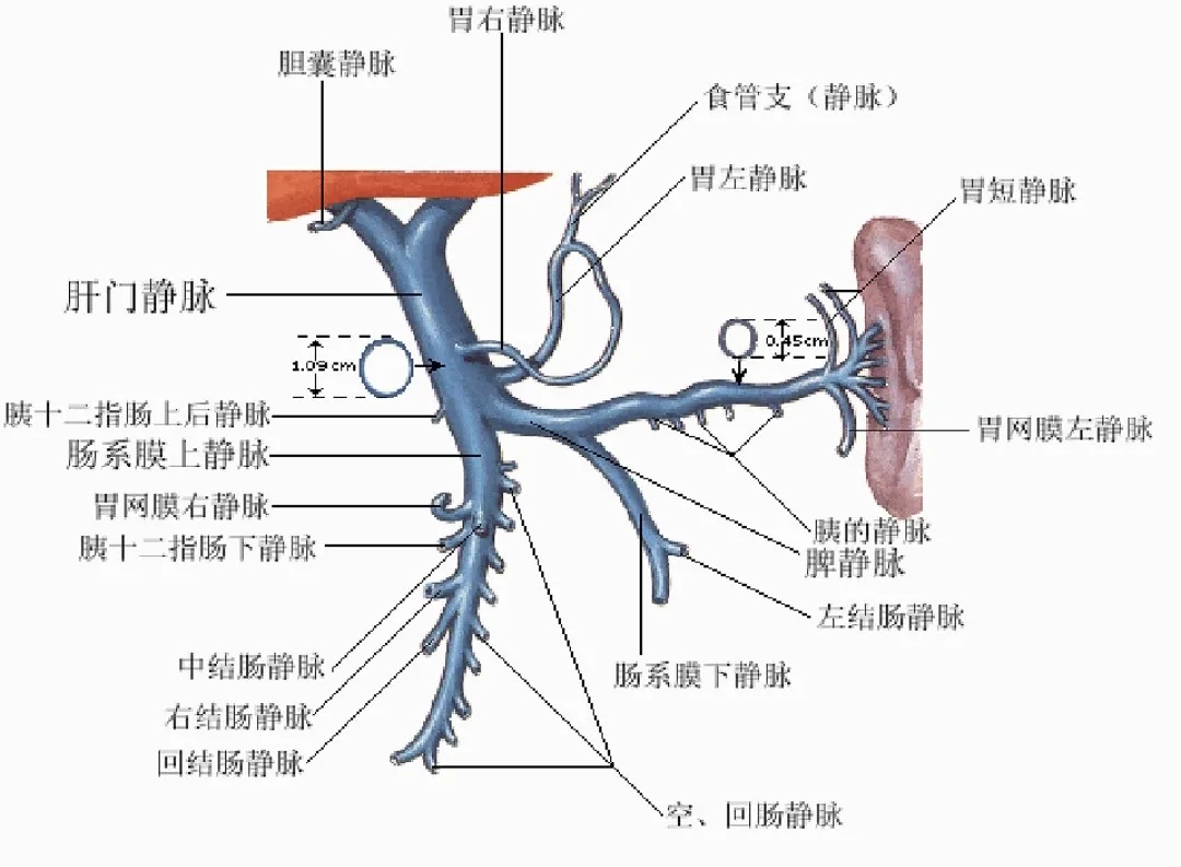 反復(fù)嘔血、黑便怎么辦？TIPS手術(shù)能解決