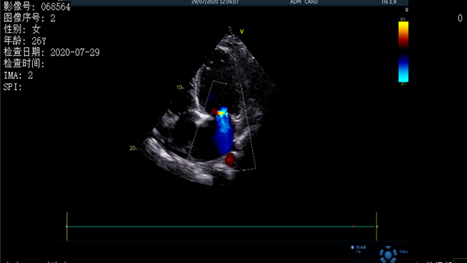 心電圖異常，心臟卻沒事，罪魁禍?zhǔn)资恰?>
				             </a>
                <div   id=