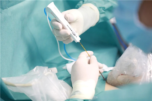 針尖上的絕絕子①｜從重慶到西安，23歲的姑娘只為了這件事……周曉東和他的超聲團隊