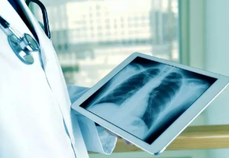 健康呼吸④體檢發(fā)現(xiàn)肺結(jié)節(jié)，我該怎么辦？