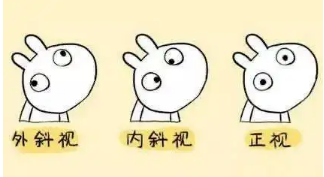 小baby老歪著頭？警惕斜頸! 這樣糾正……