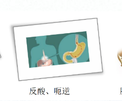 關(guān)愛身體健康，輕松檢查胃腸