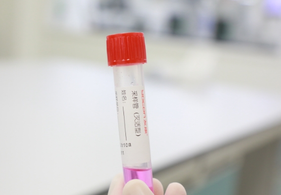 支原體感染檢測手段知多少？