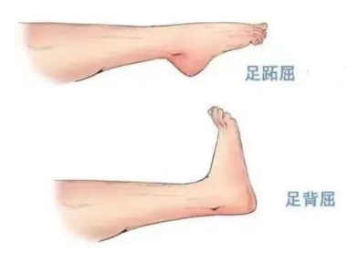 扭胯小連步、動感搖花手……“科目三”雖火，運動損傷也要防！