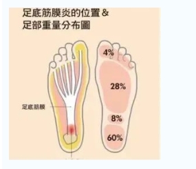 每年新生數(shù)百萬足底筋膜炎患者！國際醫(yī)學專家提醒：跑步要選擇合適的鞋